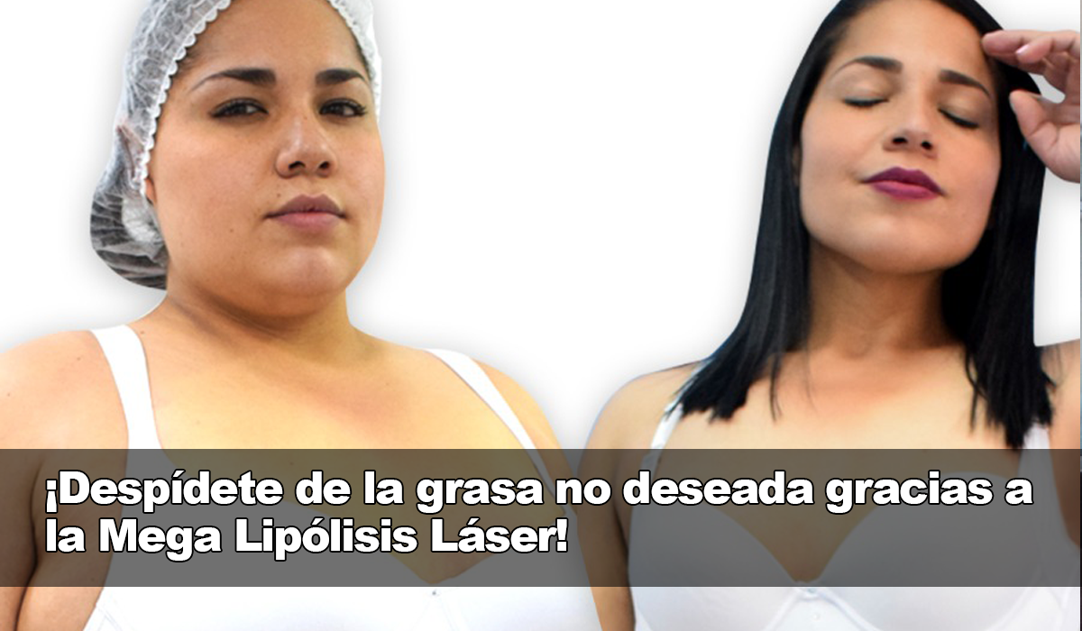 Una de las mejores alternativas para aquellos que están luchando con la grasa sobrante es la Mega Lipólisis Láser.